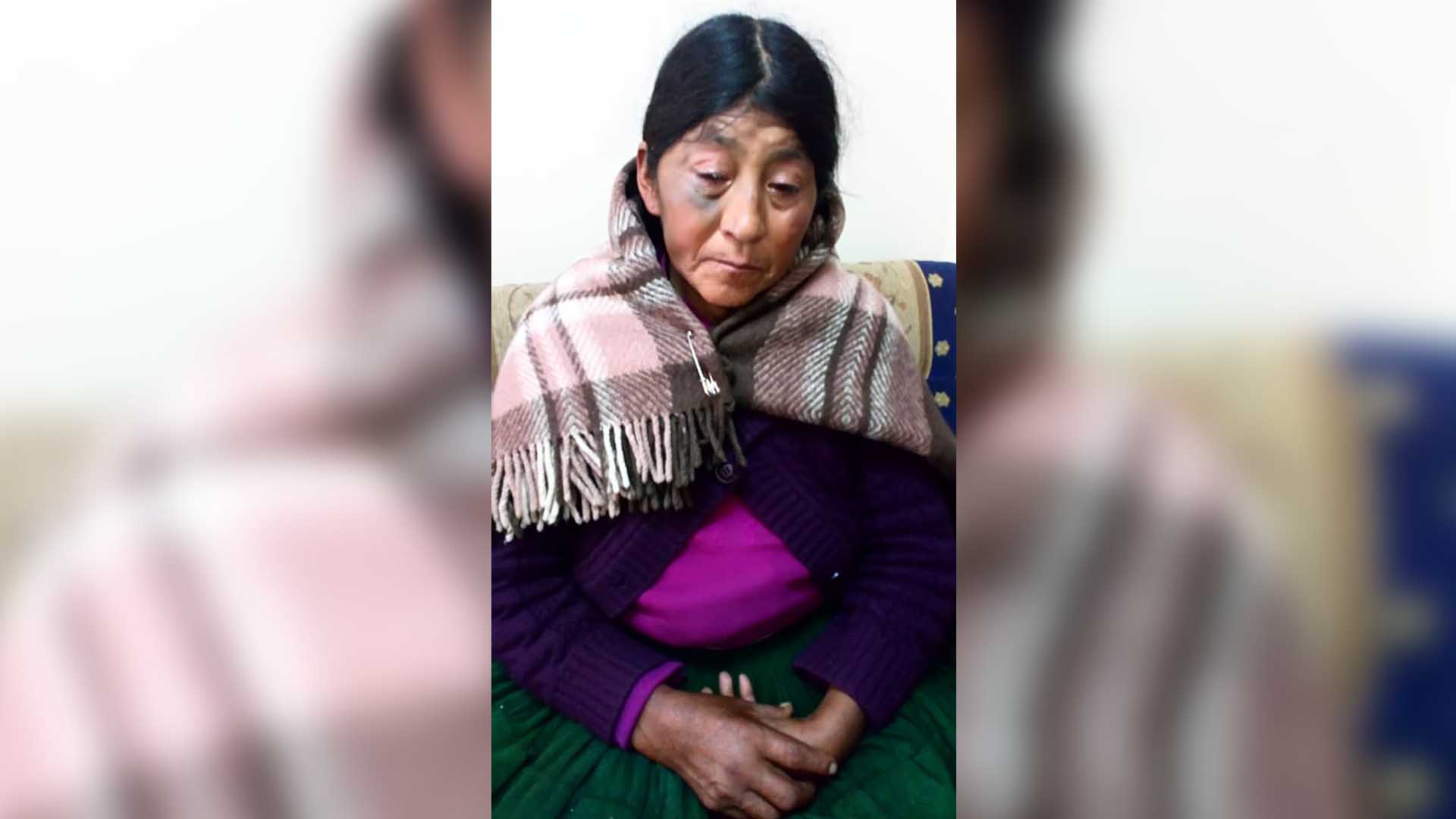Puno: Denuncian que humilde pobladora viene siendo víctima de agresión en Juli - Radio Onda Azul
