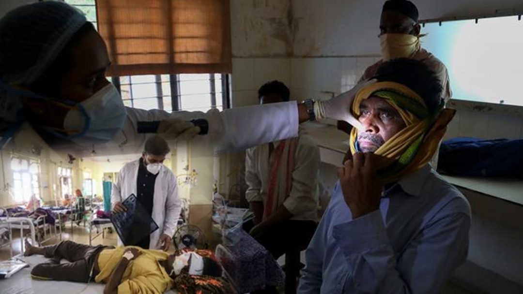 India reporta 9.000 casos de mucormicosis, la rara ...