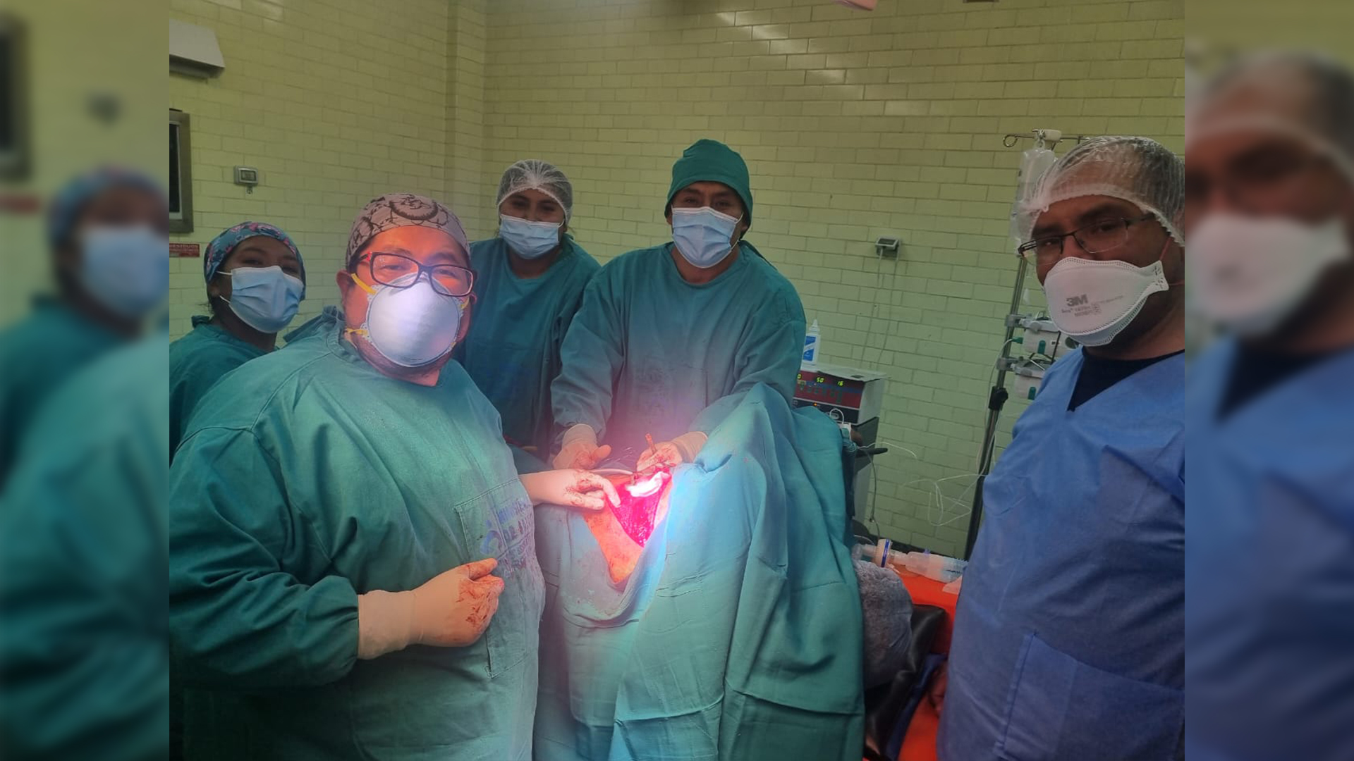 Resaltan operación cardiovascular de alta complejidad en el hospital Carlos Monge Medrano