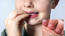 El estrés en niños pequeños
