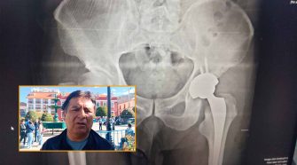 médico puneño especialista en ortopedia