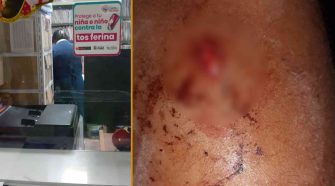 Denuncian que hospital negó atención a menor