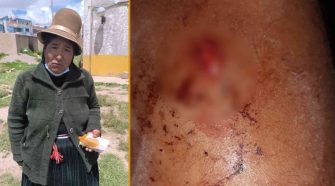 Niño de Ñuñoa lucha por su vida