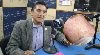 Vacunación es clave para prevenir contagio de sarampión