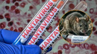 casos de hantavirus